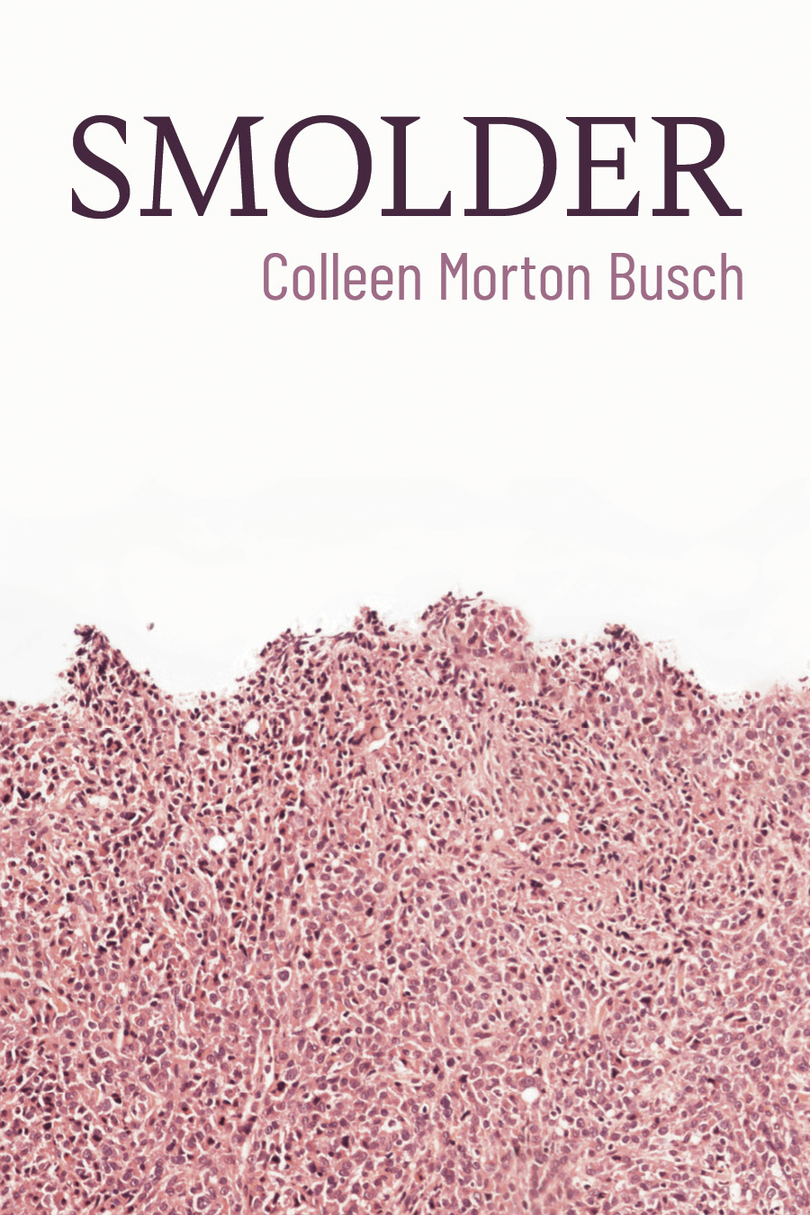 Smolder by Colleen Morton Busch forthcoming from Ex Ophidia Press in 2026